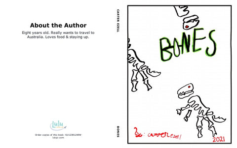 Bones